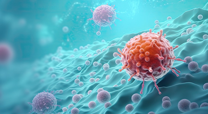 Cancer Misdiagnosis Cancer Misdiagnosis