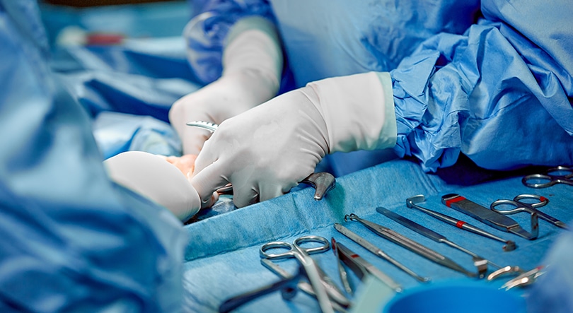 Forceps Forceps
