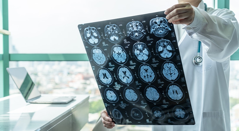 WV - Brain Injury WV - Brain Injury