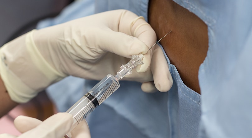 WV - Epidural WV - Epidural